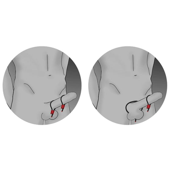 ELECTRASTIM - PRESTIGE ELECTRA LOOPS ADJUSTABLE COCK RINGS RED